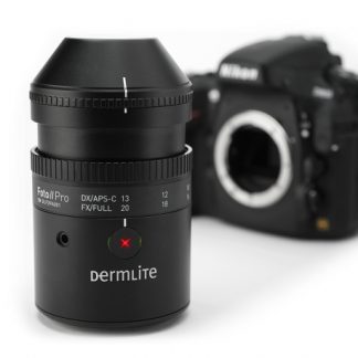 DermLite™ Foto II Pro OR DermLite™ Foto II Pro PLUS